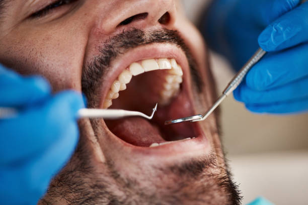 Best Walk-In Emergency Dentist in North Las Vegas, NV